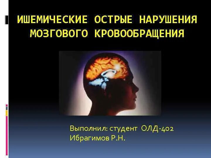 Нарушение мозгового кровообращения симптомы у взрослых. Острое нарушение мозгового кровообращения презентация. нарушения мозгового кровообращения презентация. нарушение мозгового кровообращения през.