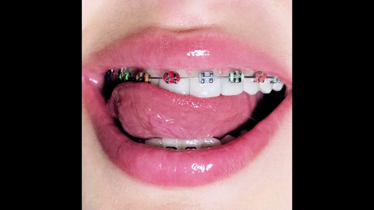 Песня брекеты гаврилина текст. Песня брекеты гаврилина текст. Песня брекеты гаврилина текст. Песня брекеты гаврилина текст. Песня брекеты гаврилина текст.