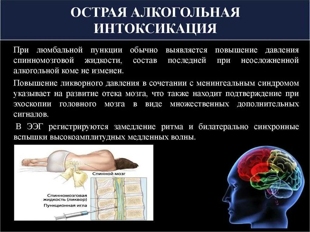 Алкогольное отравление алкоголем