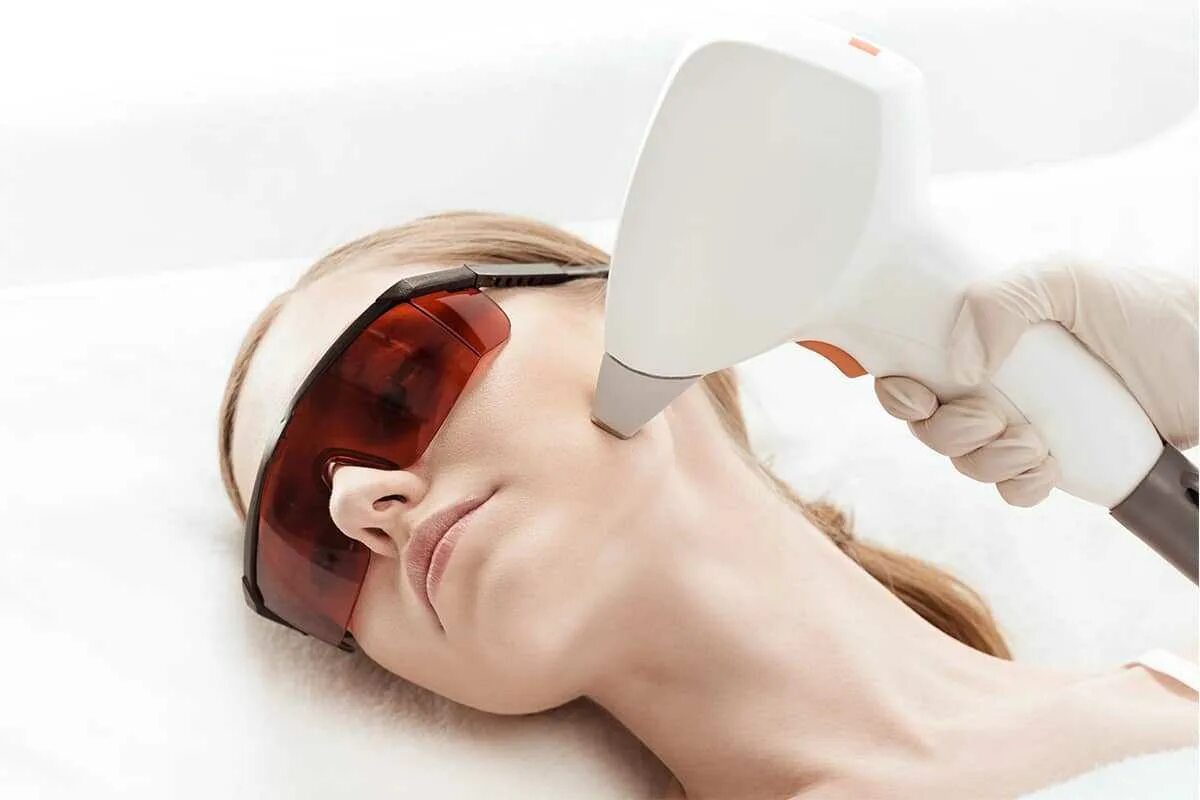 M22 resurfx фракционное омоложение. Лазерное фотолечение акне. Лазерное удаление акне. Криомассаж лица до и после. Алмазная шлифовка постакне.