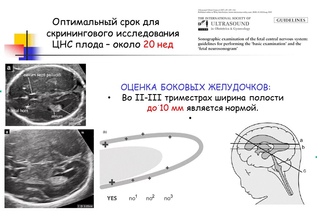 Мозг у плода норма