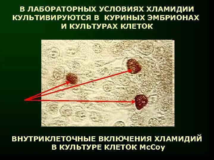 Посев на хламидии. Хламидии внутриклеточные паразиты. Микоплазмы внутриклеточные паразиты. Хламидии урогенитального хламидиоза. Хламидиоз методы диагностики.