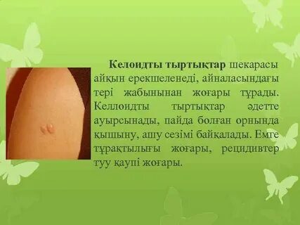 Жыныстық таңқурай