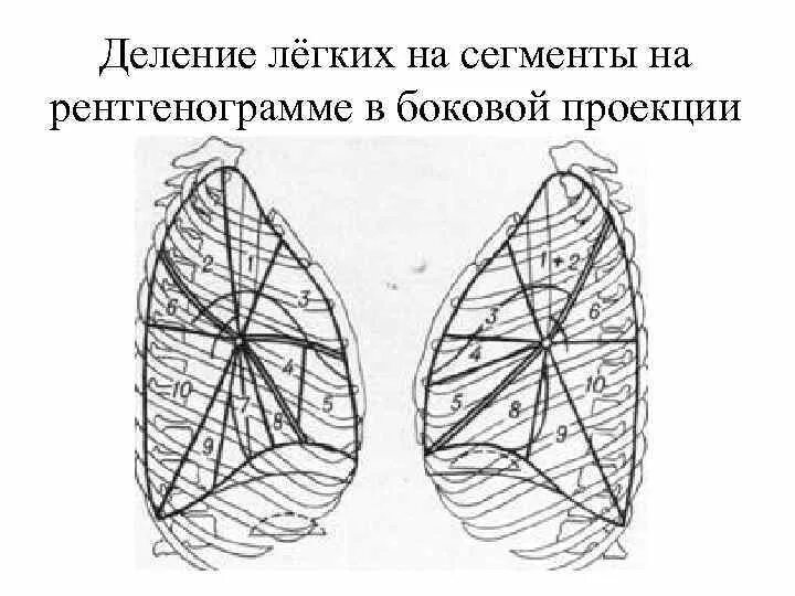 Сегментарное строение легких боковая проекция. Сегментарное строение лёгких на рентгенограмме. Сегменты левого легкого в боковой проекции. Боковая проекция долей правого легкого. Легкие в прямой проекции