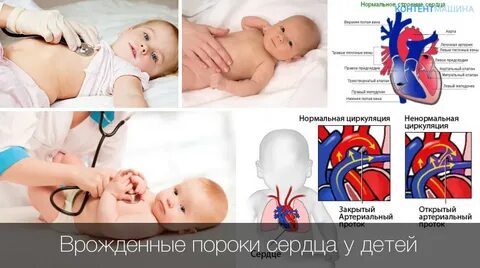 Рожают ли с пороком сердца