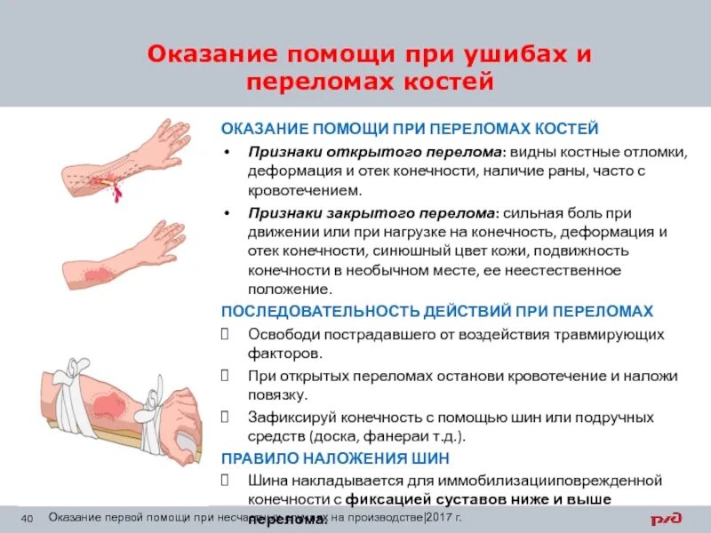 Алгоритм оказания первой помощи переломы конечностей. Меры оказания помощи при ушибах и переломах. Оказание первой помощи при переломах костей конечностей. Алгоритм оказания первой медицинской помощи при переломах ушибах.