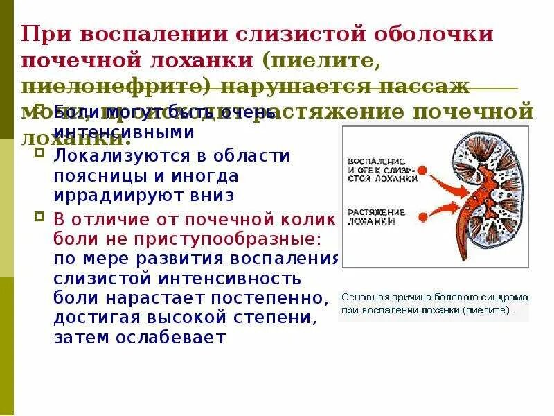 Что значит члс. Воспаление оболочки почки. Боль при воспалении почек.