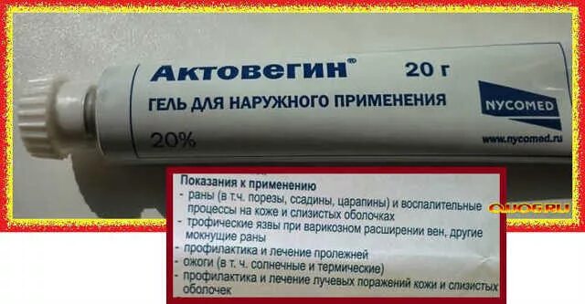 Мазь для заживления ожогов. Мазь от лучевых ожогов. Мазь от ожогов после лучевой терапии. Мази при ожогах лучевой терапии.