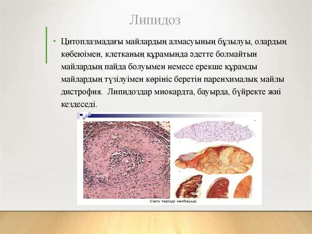 Липидоз печени. Липидоз печени у животных.