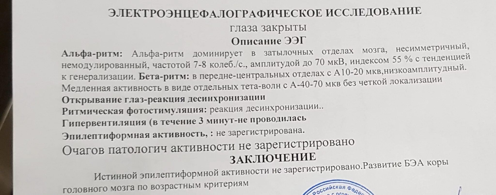 ЭЭГ норма заключение у взрослого головного. Норма ЭЭГ У детей 7 лет. ЭЭГ головного мозга заключение норма у взрослого. Пример заключения ЭЭГ здорового человека. Изменения бэа головного мозга что это