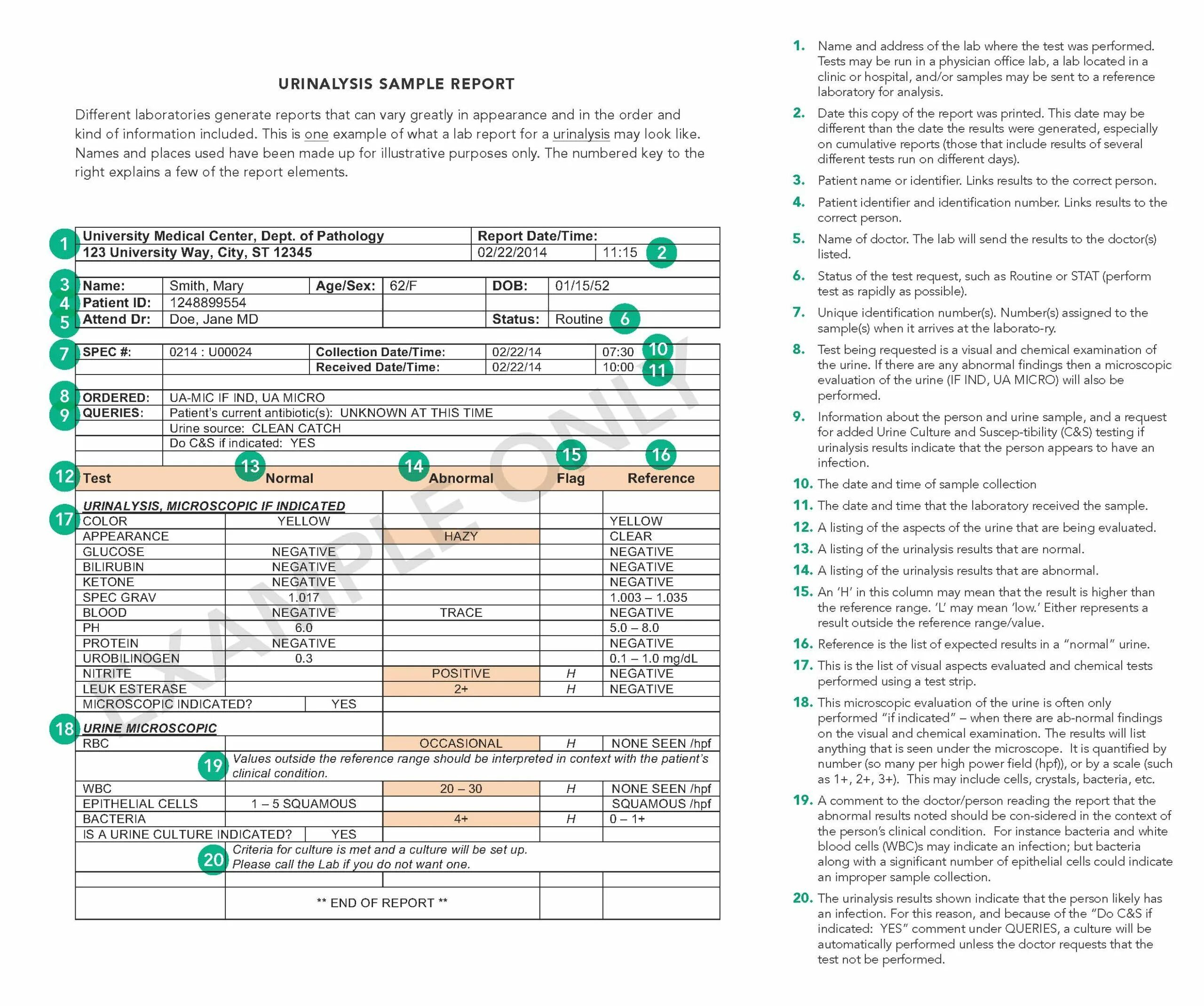 Sample result. Urine analysis report. normal urine test. urine test results.