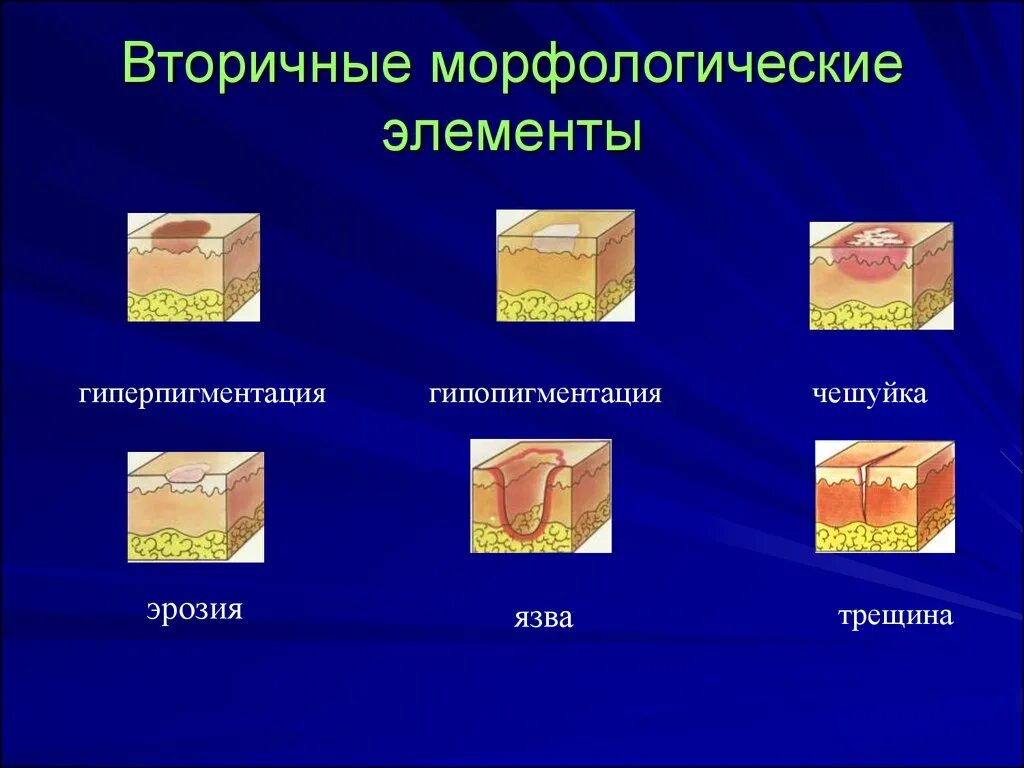 Пятно первичный элемент. Вторичные морфологические элементы кожи гиперпигментация. вторичные морфологические элементы кожи дерматовенерология. первичные морфологические элементы кожной сыпи. первичные полостные морфологические элементы кожи.