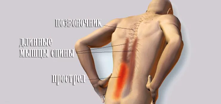 Болят мышцы спины причины. Спазм мышц поясницы. Спазмированная мышца в спине. Мышечные спазмы в спине пояснице.