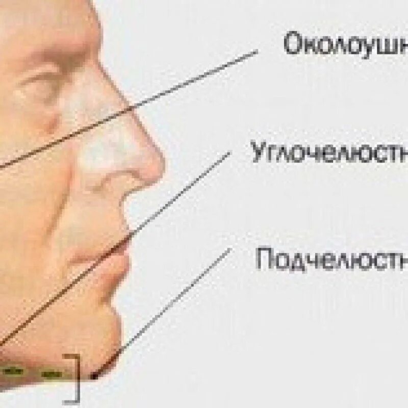 Где болит лимфоузел. Околоушные лимфатические узлы воспаление. Воспаление подчелюстного лимфатического узла. Околоушные лимфоузлы воспаление. Околоушные лимфоузлы расположение.