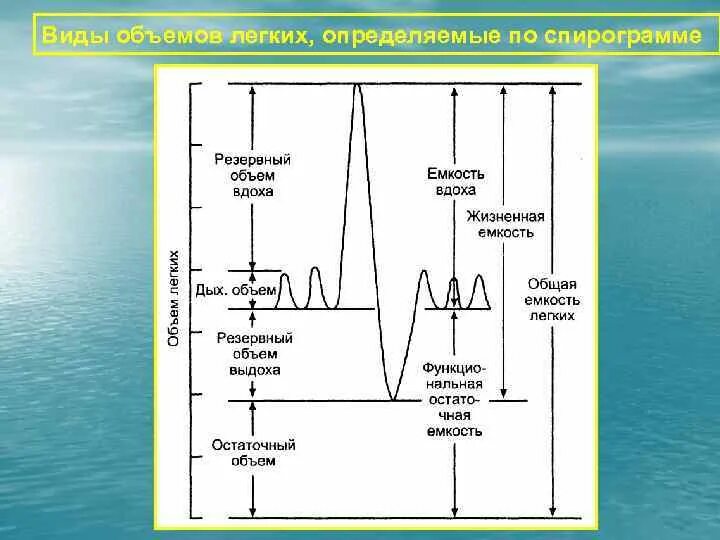 Резервный объем вдоха на спирограмме. Спирограмма легочные объемы и емкости. Спирограмма дыхания физиология. Спирограмма схема физиология. Емкость вдоха это