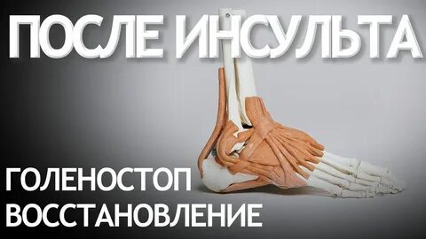 Инсульт шабанова