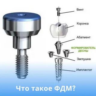 Формирователь десны на имплант