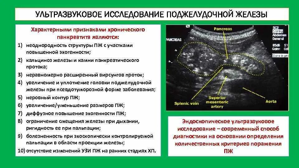 Диффузно неоднородная структура что это значит. Норма УЗИ поджелудочной железы эхоструктура. УЗИ диагностика поджелудочной железы болезни. Хронический панкреатит УЗИ изменения. Подготовка пациента Киузи поджелудочной железы.