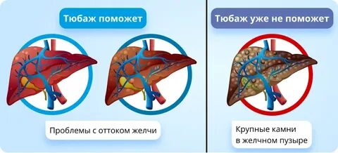 Вода поможет печени