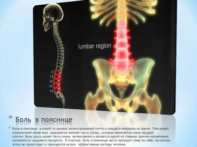 Удаление боли в пояснице. Боль в пояснице. Очень сильно болит поясница. Боль в спине в области поясницы.