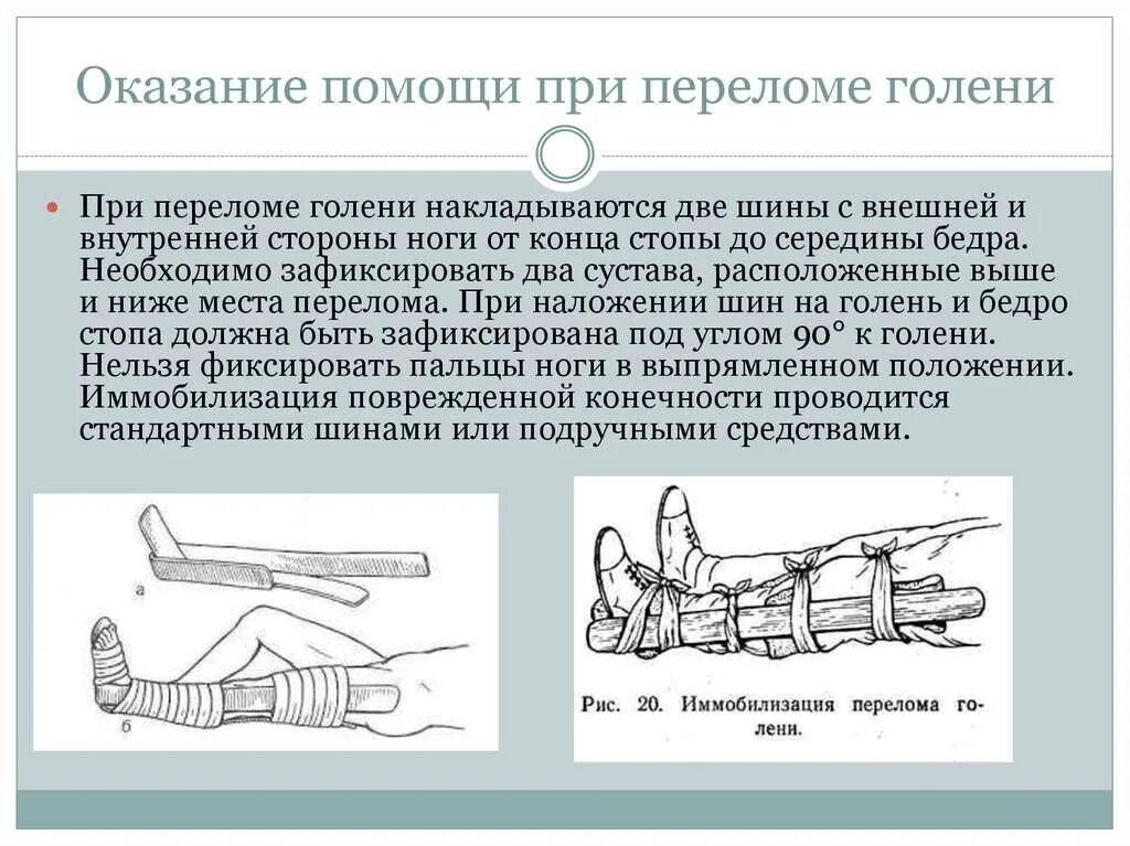 Перелом голени транспортировка. Алгоритм оказания неотложной помощи при переломах костей голени. Алгоритм оказания неотложной помощи при переломе. Оказание ПМП при переломе голени. Оказание первой помощи при закрытом переломе голени.