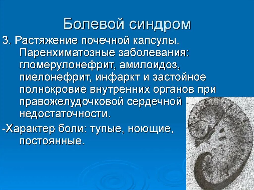 Синдром 3. Синдромы при остром пиелонефрите. болевой синдром при гломерулонефрите. болевой синдром при заболеваниях почек. паренхиматозные заболевания почек.