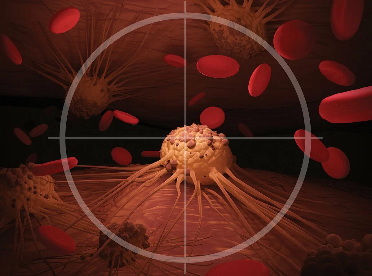 Уничтожить раковые клетки. Травы убивающие раковые клетки. Что убивает раковые клетки в организме. Женские раковые клетки. Иммунотерапия и таргетная терапия.