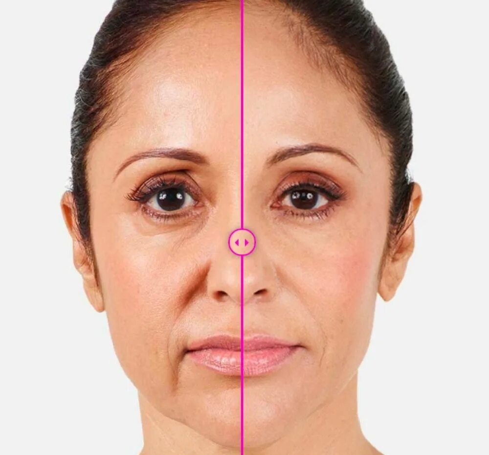 Pin by Carol Chipoletti on Anatomia Facial muscles, Facial, Sea and ocean