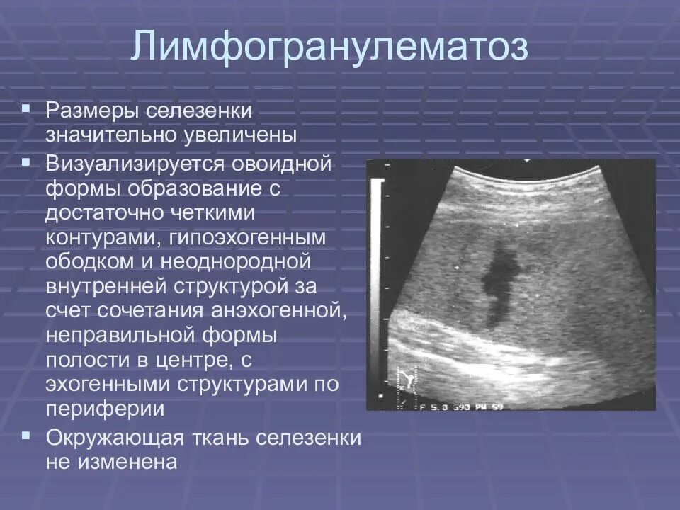 Очаговое образование по типу