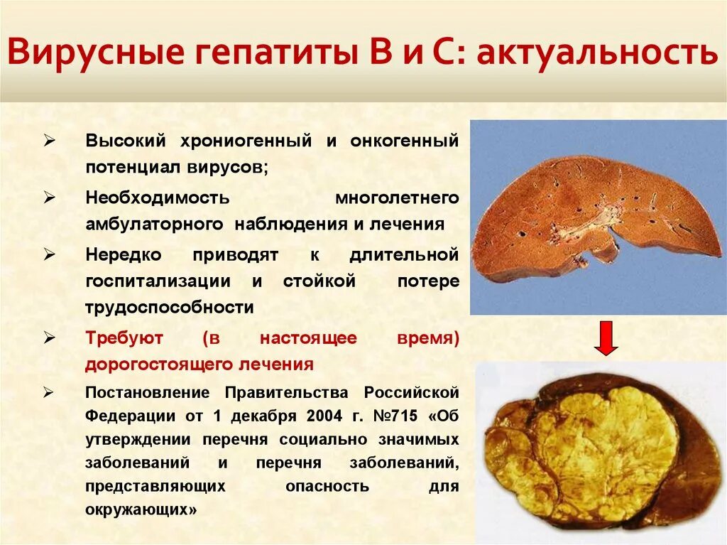 Актуальность вирусных гепатитов. Вирусные гепатиты актуальность проблемы. Актуальность вирус гепатита в. Вирусные гепатиты актуальность темы. Гепатит народное