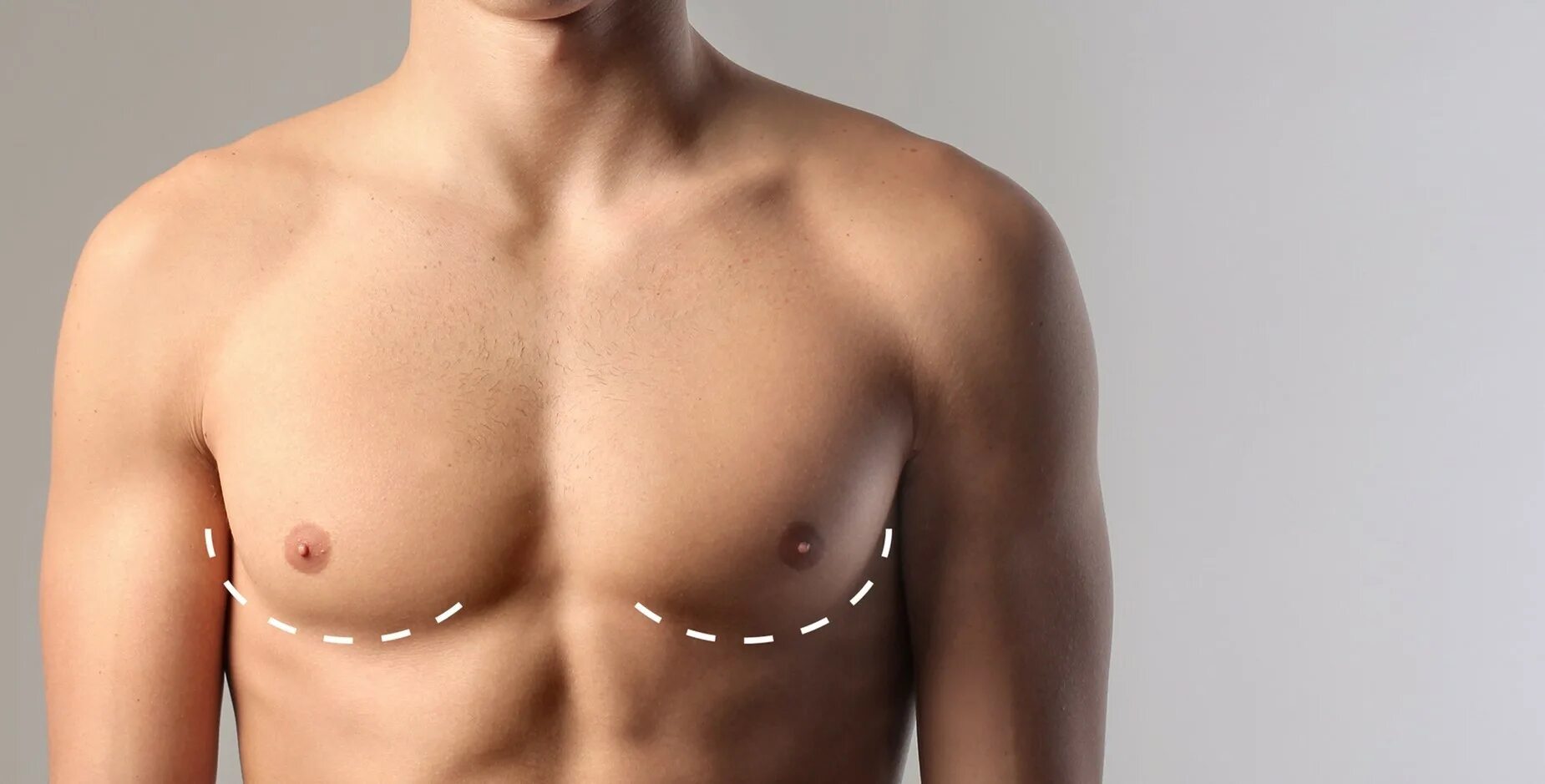 Молочной железы у мужчин симптомы. Мужская грудь. Мужская грудная клетка. Квадратная грудь.