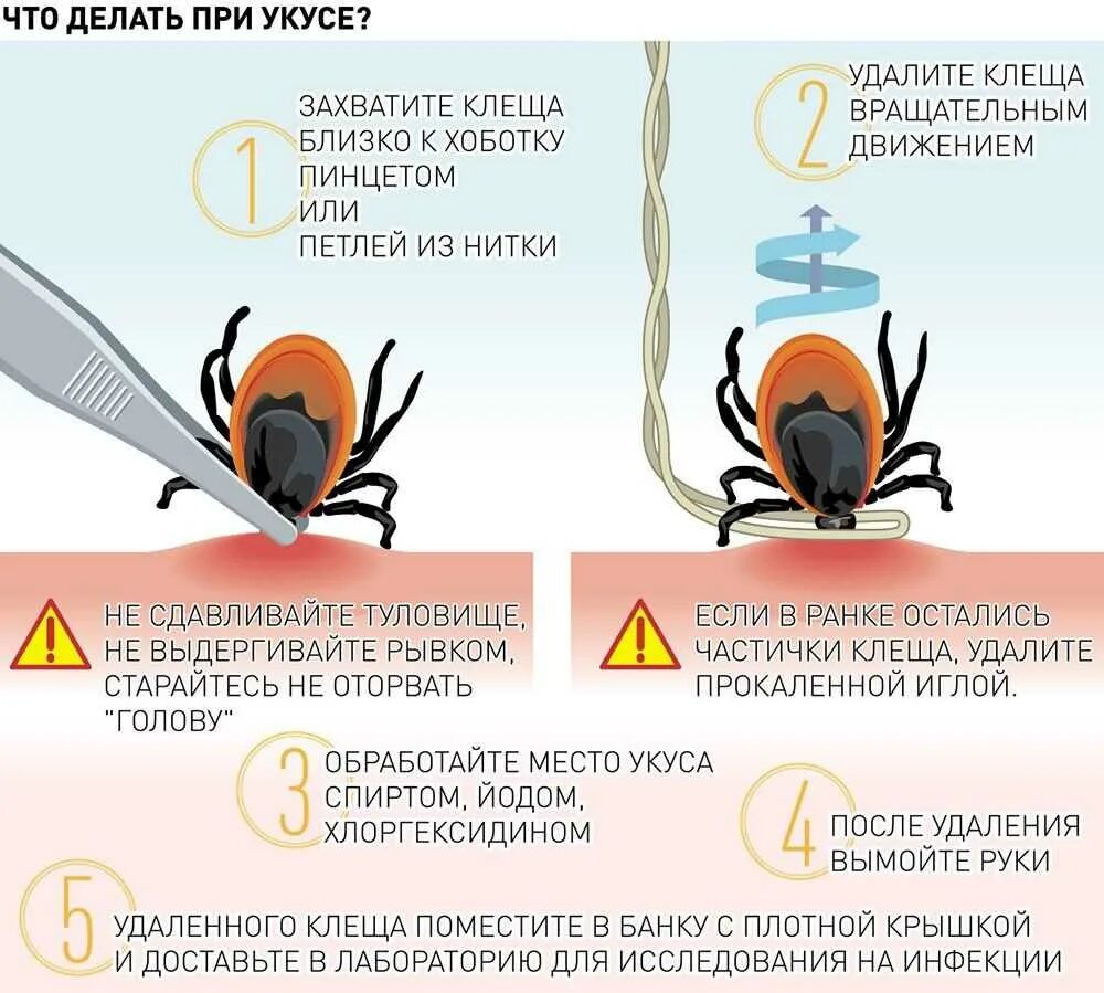 Симптомы энцефалита у человека после укуса клеща. Клещи. Места присасывания клеща схема.