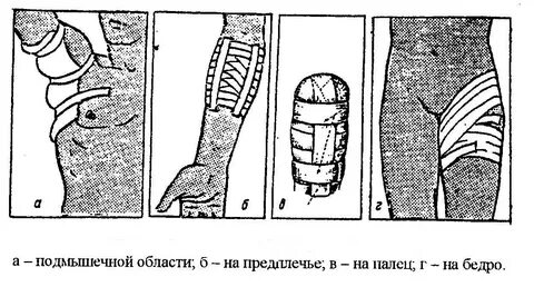 Лейкопластырная повязка