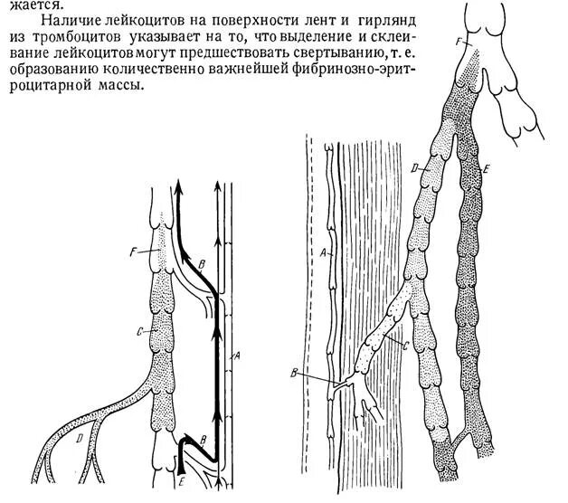Строение тромба головка тело хвост. Структура тромба. Части тромбов