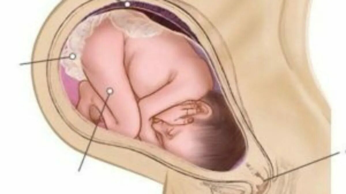 Выпирает живот у детей. 36 недель беременности картинка. 38 недель шевеления форум. Вес плода на 34 неделе беременности. Ребенок толкается в животе.