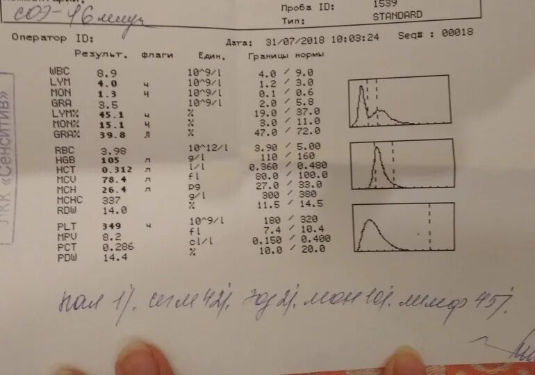 Плохой анализ крови. Гистограмма RBC В анализе крови. PLT гистограмма анализ крови. Чек анализатора общего анализа крови.