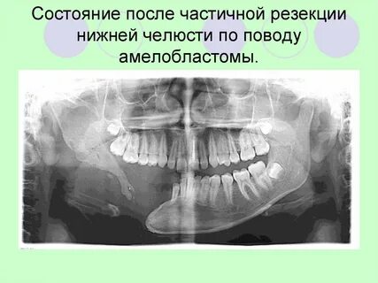 Почему опухли челюсти
