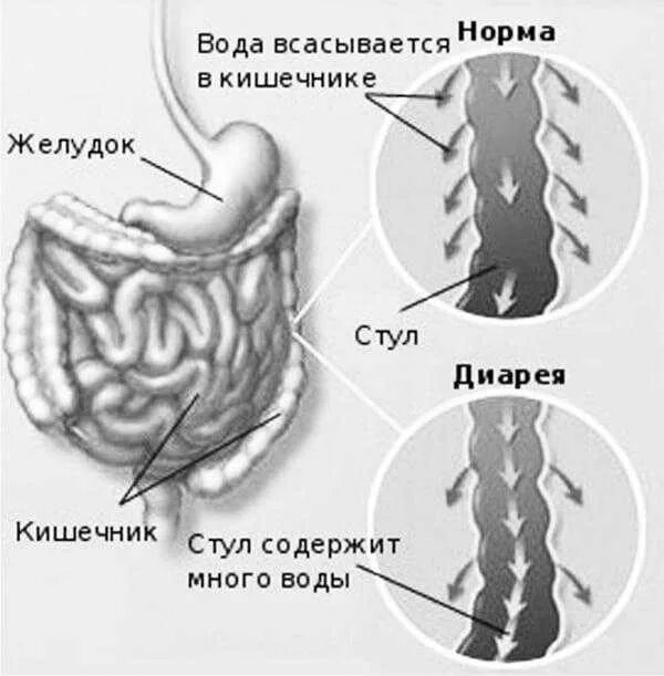 Болезненный кишечник. Спастические боли в кишечнике.