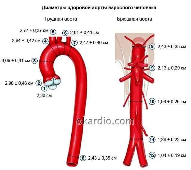 Площадь поперечного сечения аорты. Аорта брюшного отдела норма диаметр аорты. нормальный диаметр дуги аорты. диаметр восходящего отдела грудной аорты. аневризма восходящего отдела аорты норма.