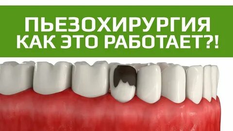 Удаление зуба форум отзывы