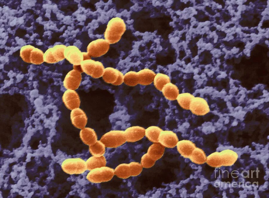 Streptococcus thermophilus. Термофильный стрептококк. термофилус стрептококк. streptococcus thermophilus стрептококк термофильный. streptococcus salivarius subsp. thermophilus.