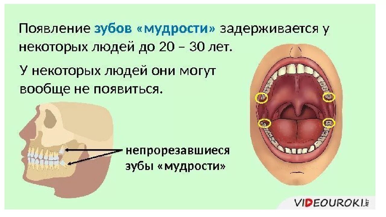 Почему зубы мудрости так называются. Где растет зуб мудрости.