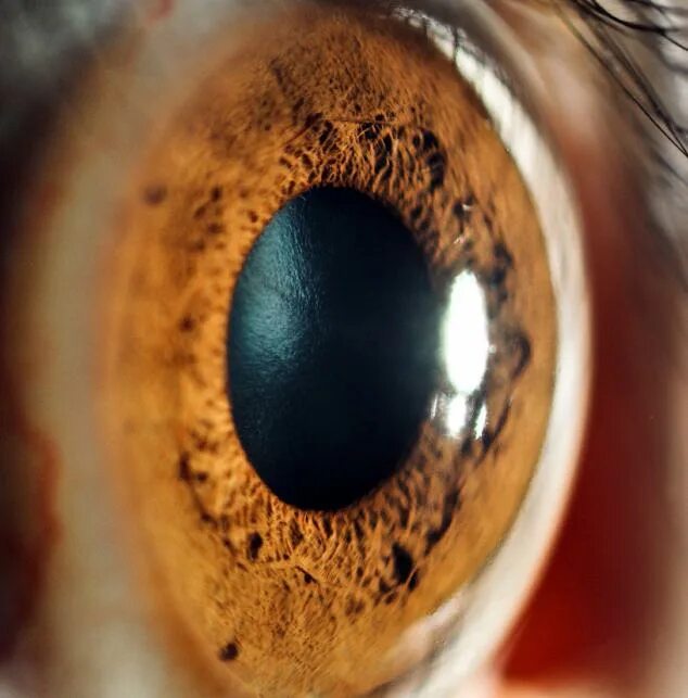 Функциональные аппараты глазного яблока светопреломляющий. Катаракта схема глаза. Анатомическое строение глаза человека. Образование хрусталика. Хрусталик строение анатомия.