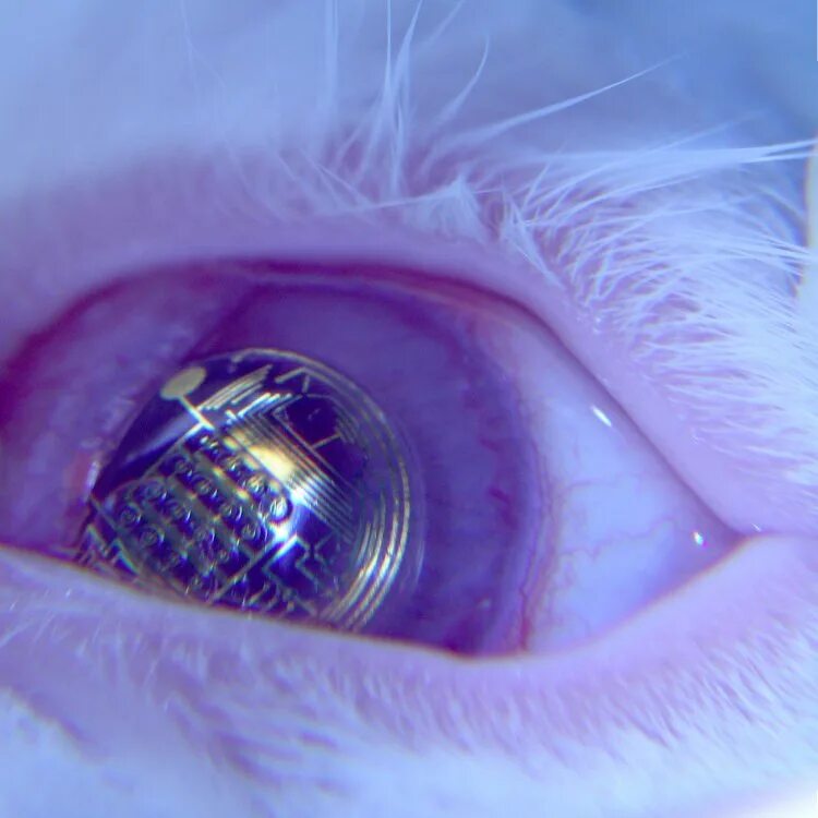 где вставить глаз