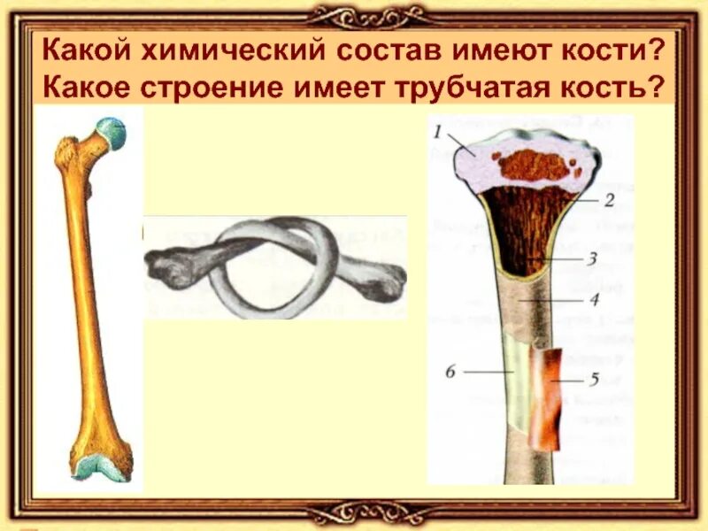 Какое строение имеют кости. Строение трубчатой кости. Строение длинной трубчатой кости. Какое строение имеет трубчатая кость. Что имеют трубчатые кости.