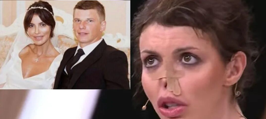 Экс супруга читать. Экс супруга читать. Анжелика удалова жена игоря удалова. Алиса казьмина аршавина что с носом. Алиса казьмина сейчас нос.