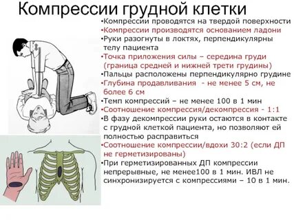 Компрессии на грудину взрослого человека необходимо