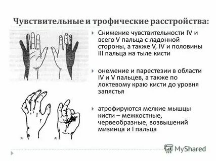 Пропадает чувствительность руки