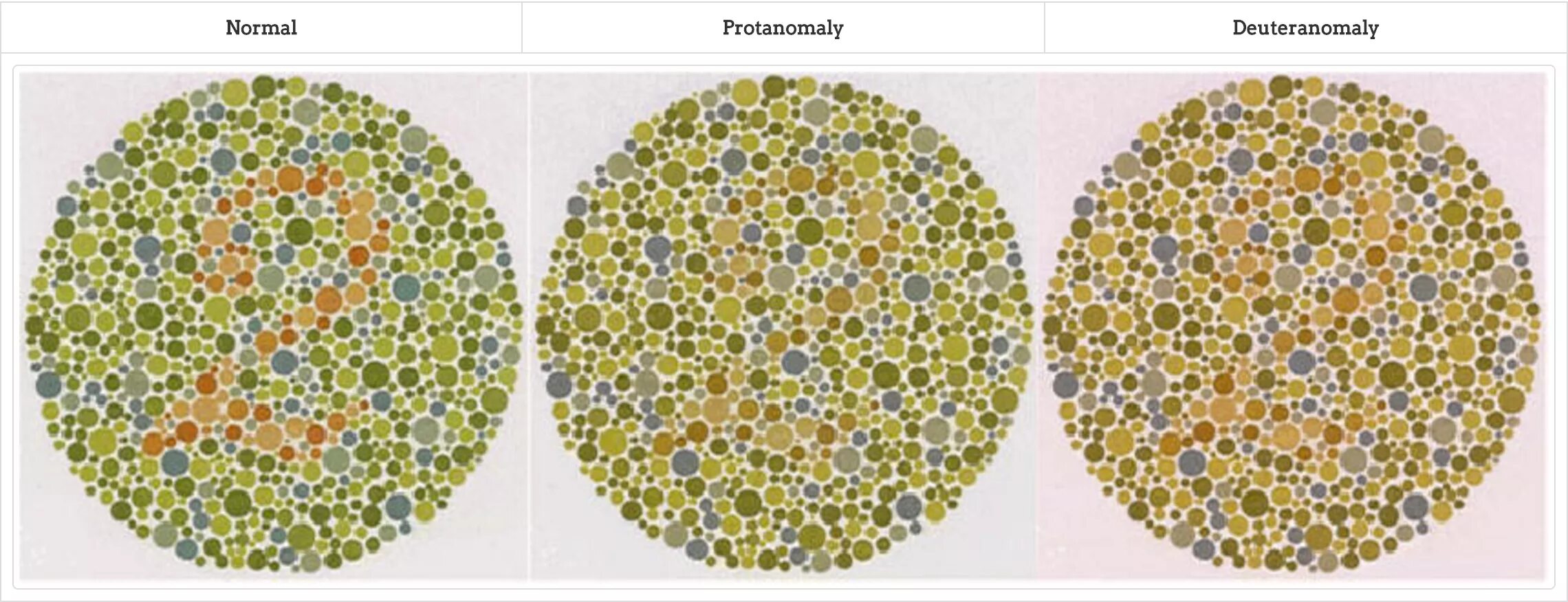 Дальтонизм дейтеранопия. Protan дальтонизм. Тританопический дальтонизм. Дальтонизм ахроматопсия.