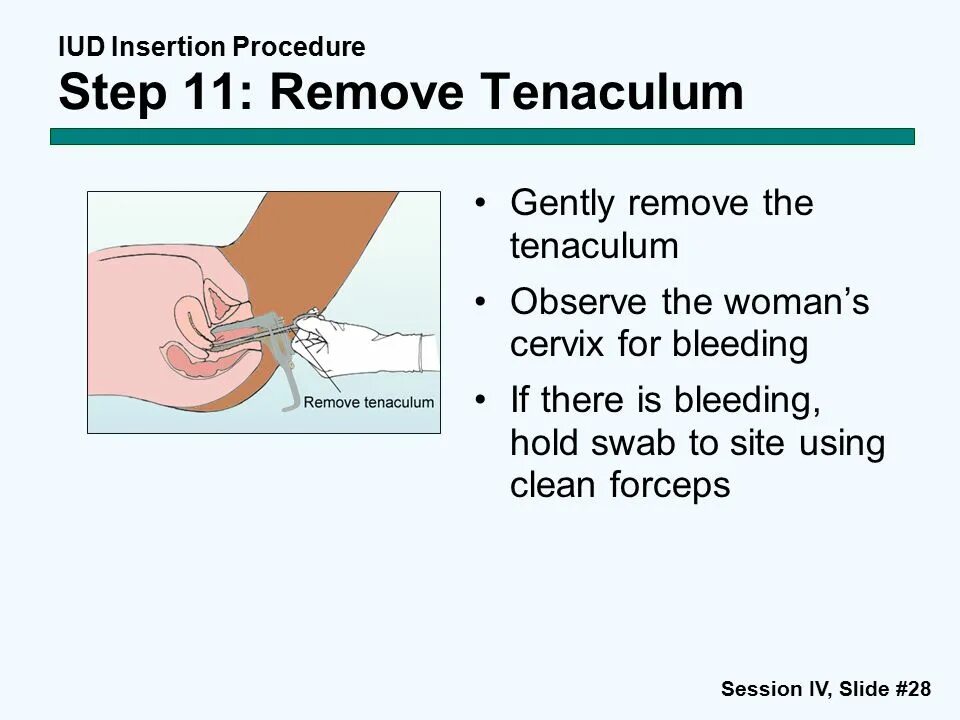 Gently remove